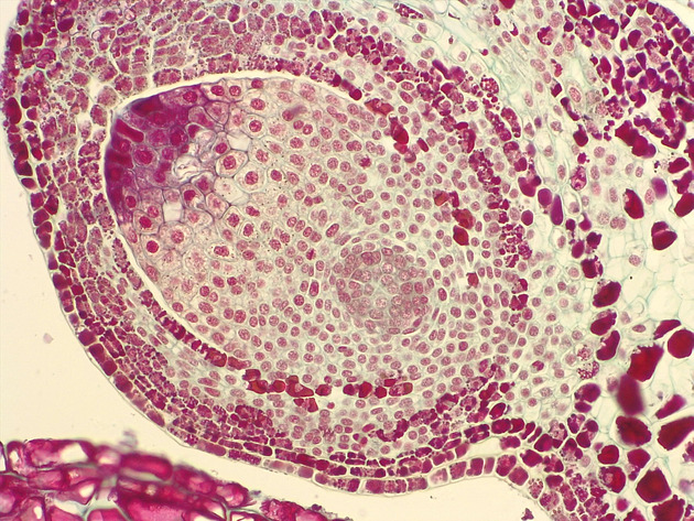 Female Pine Ovule Slides - Female Pine Ovule 01 200X